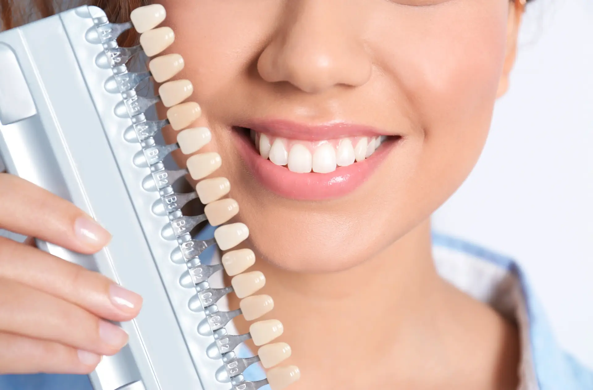 VENEERS GEEIGNET