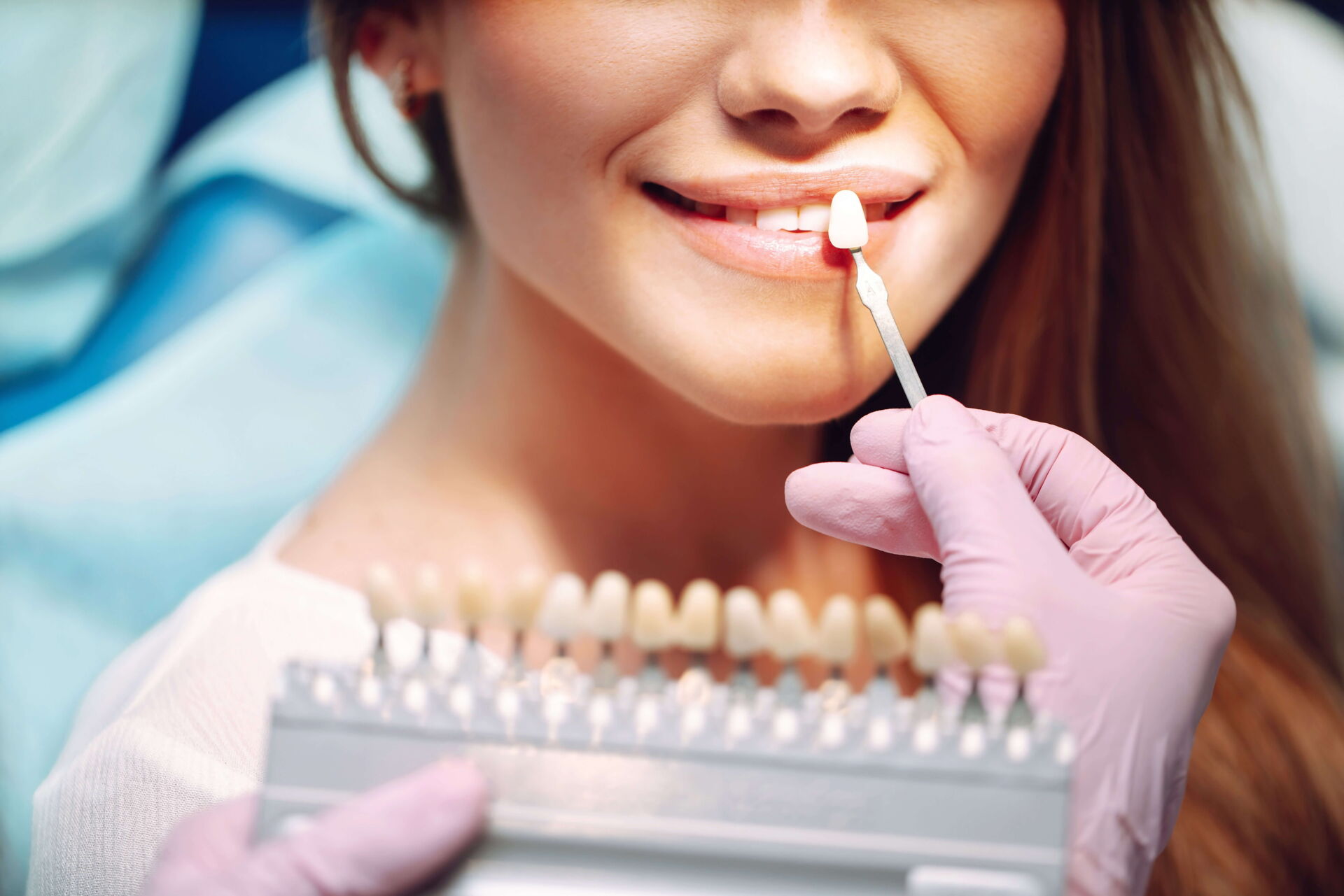 Anprobe der Veneers, Farb- und Sitzkontrolle